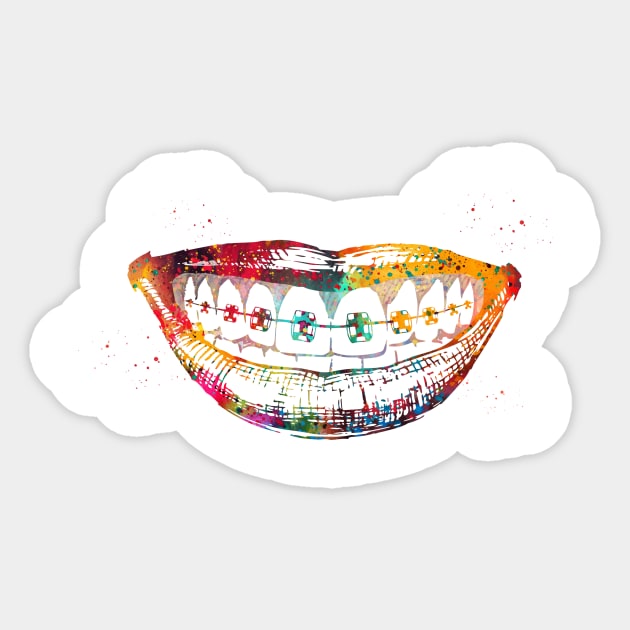 Teeth braces Sticker by erzebeth